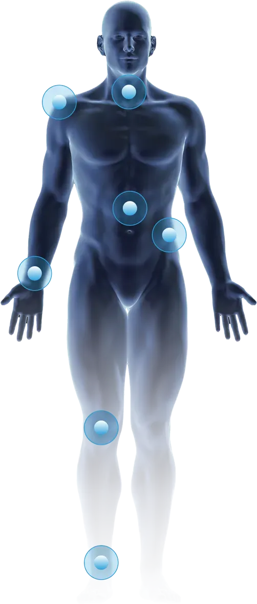 Body diagram highlighting the treatment areas the NICE1 wraps cover